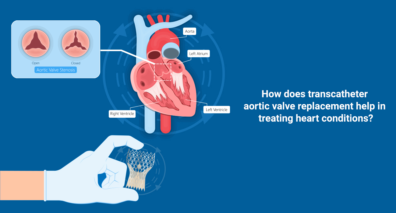 How does Transcatheter Aortic Valve replacement help in treating Heart conditions?